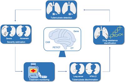 The Application of Artificial Intelligence in the Diagnosis and Drug Resistance Prediction of Pulmonary Tuberculosis